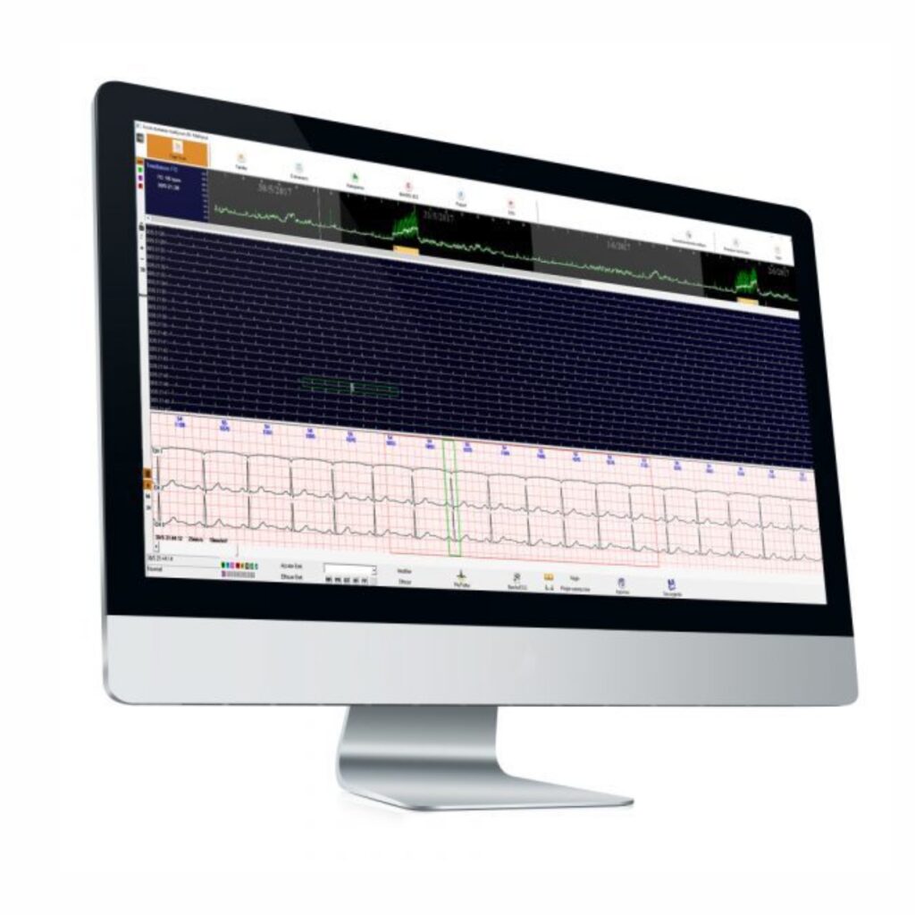 pose holter ecg