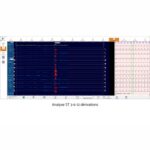 ecg électrodes