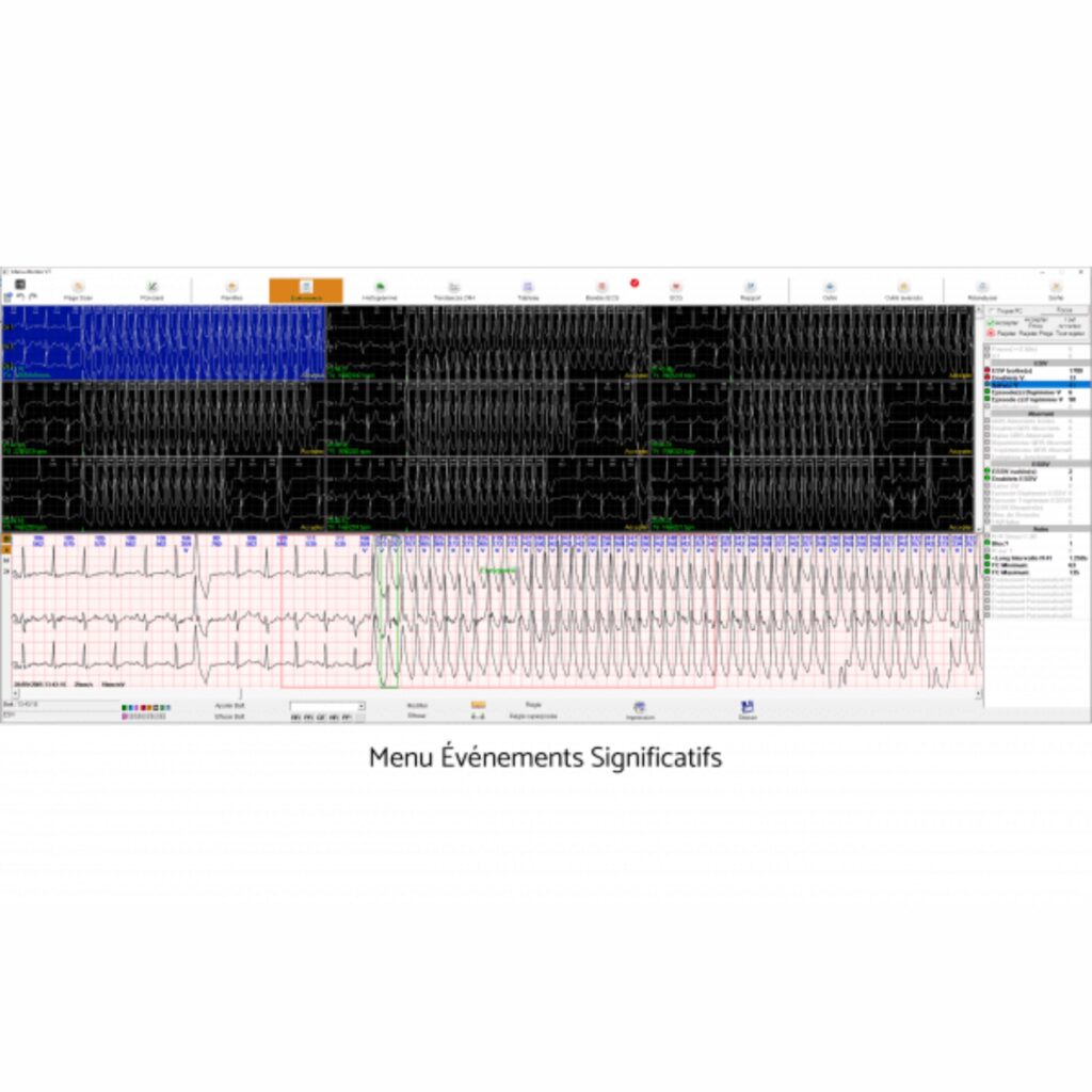 holter ecg holter