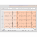 ecg-de-repos
