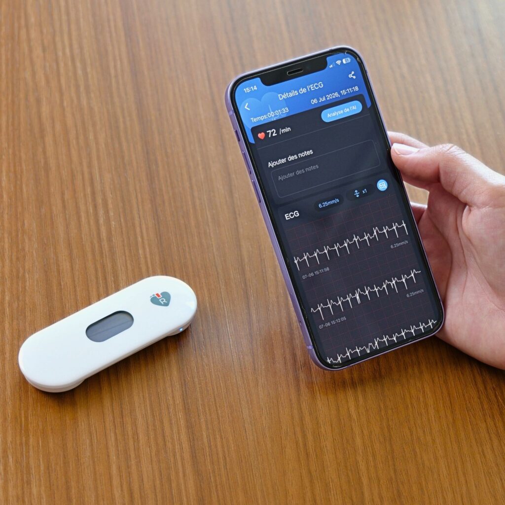 ecg mobile app
